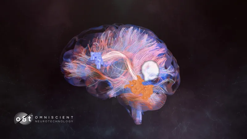 NRFC Invests $20 Million to Scale Omniscient Neurotechnology’s Revolutionary Brain Mapping Globally